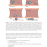 2024-2025 Basic and Clinical Science Course, Section 9: Uveitis and Ocular Inflammation