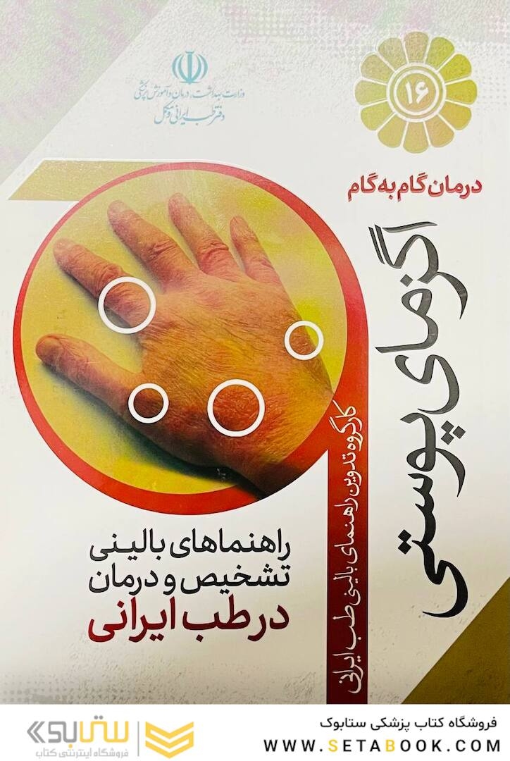 درمان گام به گام اگزمای پوستی