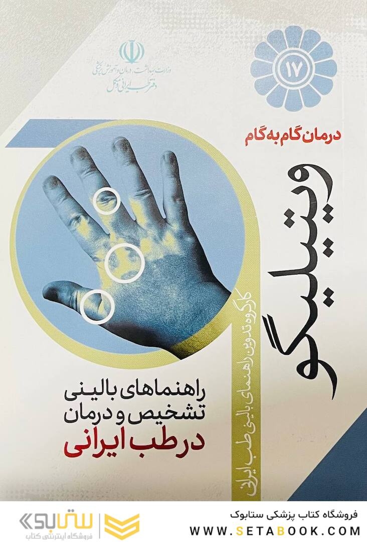 درمان گام به گام ویتیلیگو