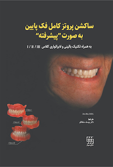 عکس ساکشن پروتز کامل فک پایین به صورت پیشرفته