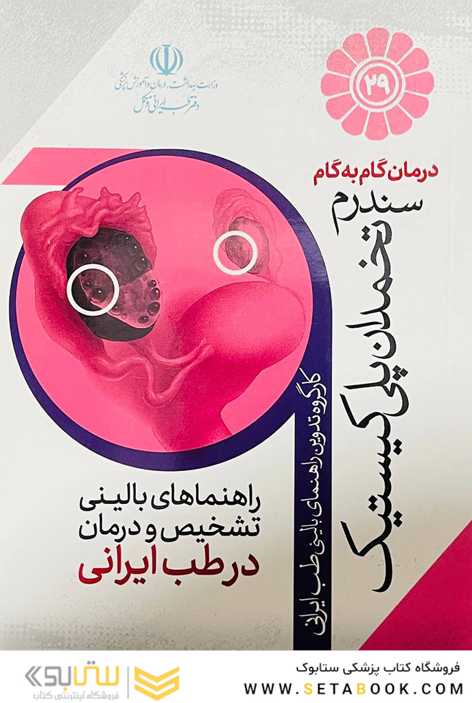 درمان گام به گام سندرم تخمدان پلی کیستیک