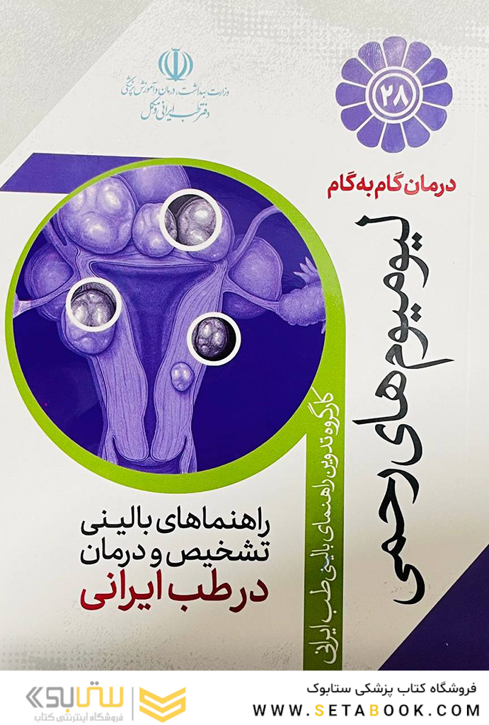 درمان گام به گام لیومیوم های رحمی
