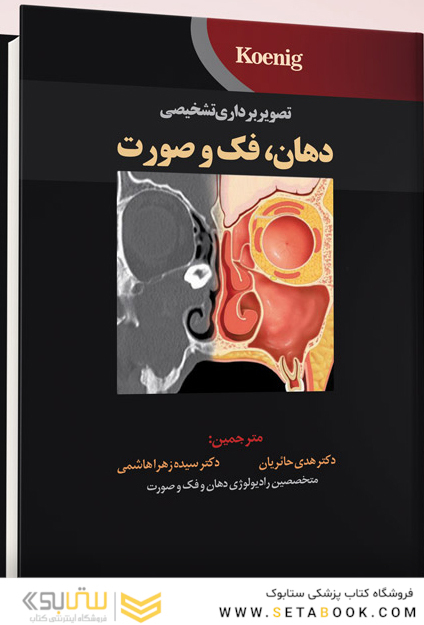 تصویربرداری تشخیصی دهان، فک و صورت  koenig