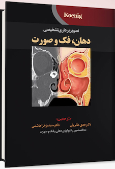 عکس تصویربرداری تشخیصی دهان، فک و صورت  koenig