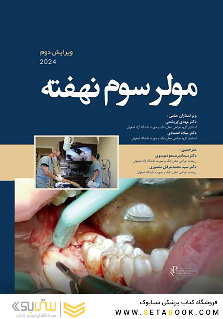 مولر سوم نهفته 2024