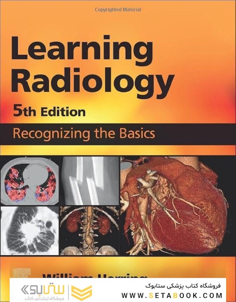 Learning Radiology Recognizing the Basics 5th Edition 2024