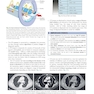 Learning Radiology Recognizing the Basics 5th Edition 2024