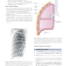 Learning Radiology Recognizing the Basics 5th Edition 2024