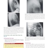 Learning Radiology Recognizing the Basics 5th Edition 2024