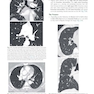 Learning Radiology Recognizing the Basics 5th Edition 2024