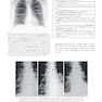 Learning Radiology Recognizing the Basics 5th Edition 2024