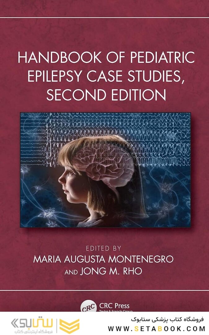 Handbook of Pediatric Epilepsy Case Studies,  2nd Edition 2023