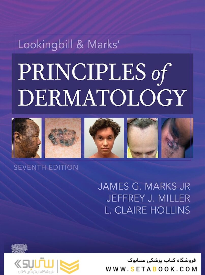 Lookingbill & Marks’ Principles of Dermatology 2024