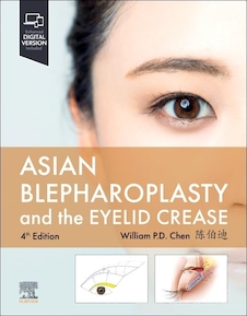 عکس Asian Blepharoplasty and the Eyelid Crease 2024