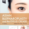 Asian Blepharoplasty and the Eyelid Crease 2024
