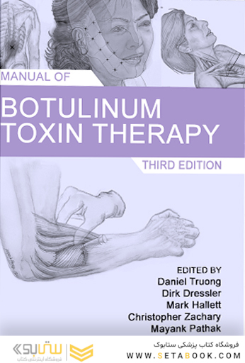 Manual of Botulinum Toxin Therapy 3rd Edition