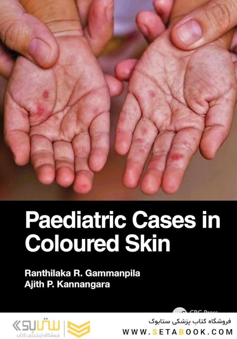 Paediatric Cases in Coloured Skin 1st Edition