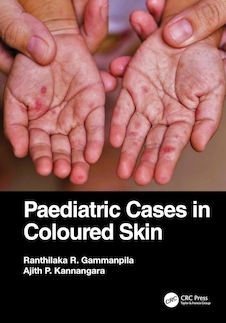 عکس Paediatric Cases in Coloured Skin 1st Edition