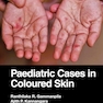 Paediatric Cases in Coloured Skin 1st Edition