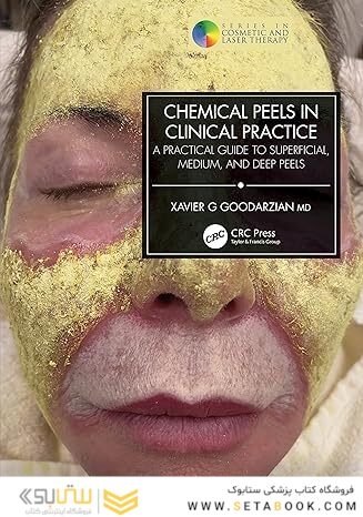 Chemical Peels in Clinical Practice: A Practical Guide to Superficial, Medium, and Deep Peels (Series in Cosmetic and Laser Therapy) 1st Edition