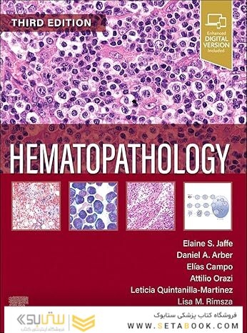 Hematopathology 3rd Edition