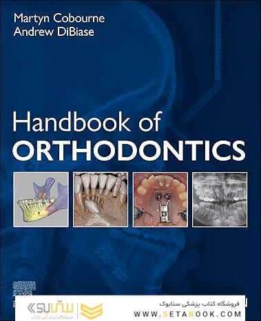 Handbook of Orthodontics E-Book 3rd Edition