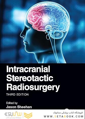 Intracranial Stereotactic Radiosurgery 3rd Edition