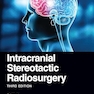 Intracranial Stereotactic Radiosurgery 3rd Edition