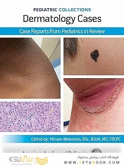 Pediatric Collections: Dermatology Cases: Case Reports from Pediatrics in Review