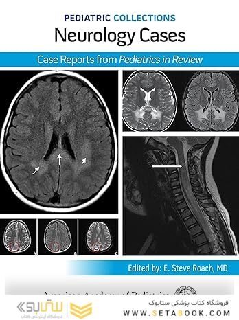 Pediatric Collections: Neurology Cases: Case Reports from Pediatrics in Review