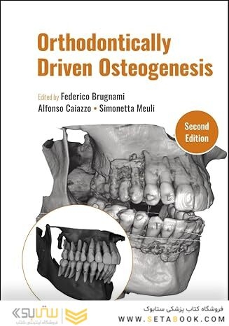 Orthodontically Driven Osteogenesis 2nd Edition