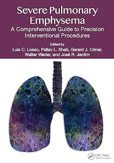 عکس Severe Pulmonary Emphysema:: A Comprehensive Guide to Precision Interventional Procedures 1st Edition