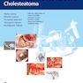 Microsurgical Management of Middle Ear and Petrous Bone Cholesteatoma 1st Edition