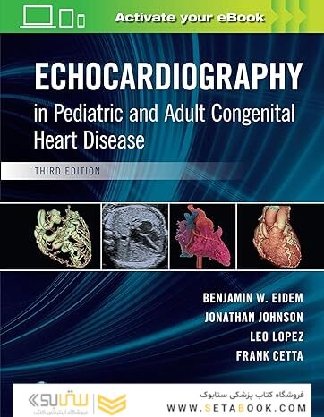 Echocardiography in Pediatric and Adult Congenital Heart Disease 3rd Edition