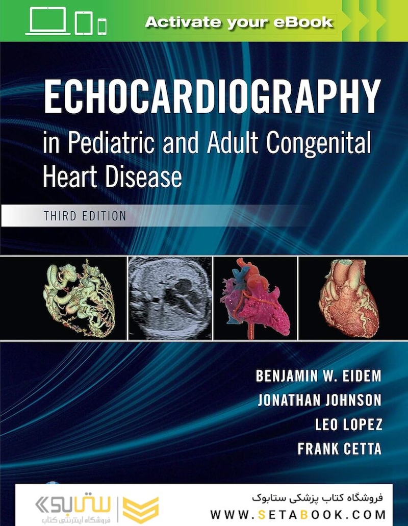 Echocardiography in Pediatric and Adult Congenital Heart Disease 3rd Edition