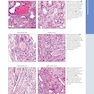 Diagnostic Pathology: Kidney Diseases 4th Edicion 2023