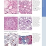 Diagnostic Pathology: Kidney Diseases 4th Edicion 2023