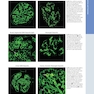 Diagnostic Pathology: Kidney Diseases 4th Edicion 2023