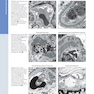 Diagnostic Pathology: Kidney Diseases 4th Edicion 2023