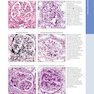 Diagnostic Pathology: Kidney Diseases 4th Edicion 2023