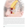 Thread Lifting Techniques for Facial Rejuvenation and Recontouring