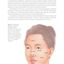 Thread Lifting Techniques for Facial Rejuvenation and Recontouring