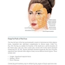 Thread Lifting Techniques for Facial Rejuvenation and Recontouring