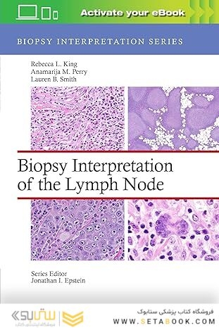 Biopsy Interpretation of the Lymph Node:(Biopsy Interpretation Series) First Edition
