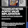 Transcatheter Aortic Valve Implantation: Current and Future Developments 2nd Edition