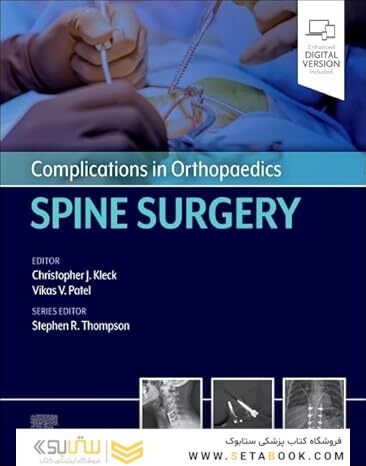 Complications in Orthopaedics: Spine Surgery 1st Edition