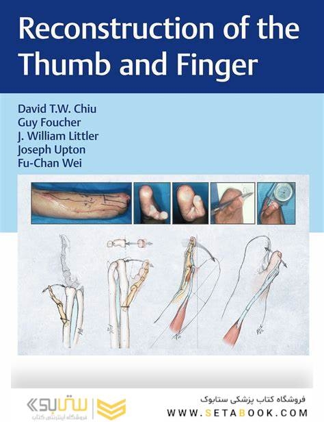 Reconstruction of the Thumb and Finger