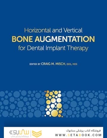 Horizontal and Vertical Bone Augmentation for Dental Implant Therapy