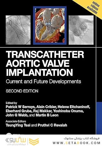 Transcatheter Aortic Valve Implantation: Current and Future Developments 2nd Edition