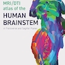 MRI/DTI Atlas of the Human Brainstem in Transverse and Sagittal Planes